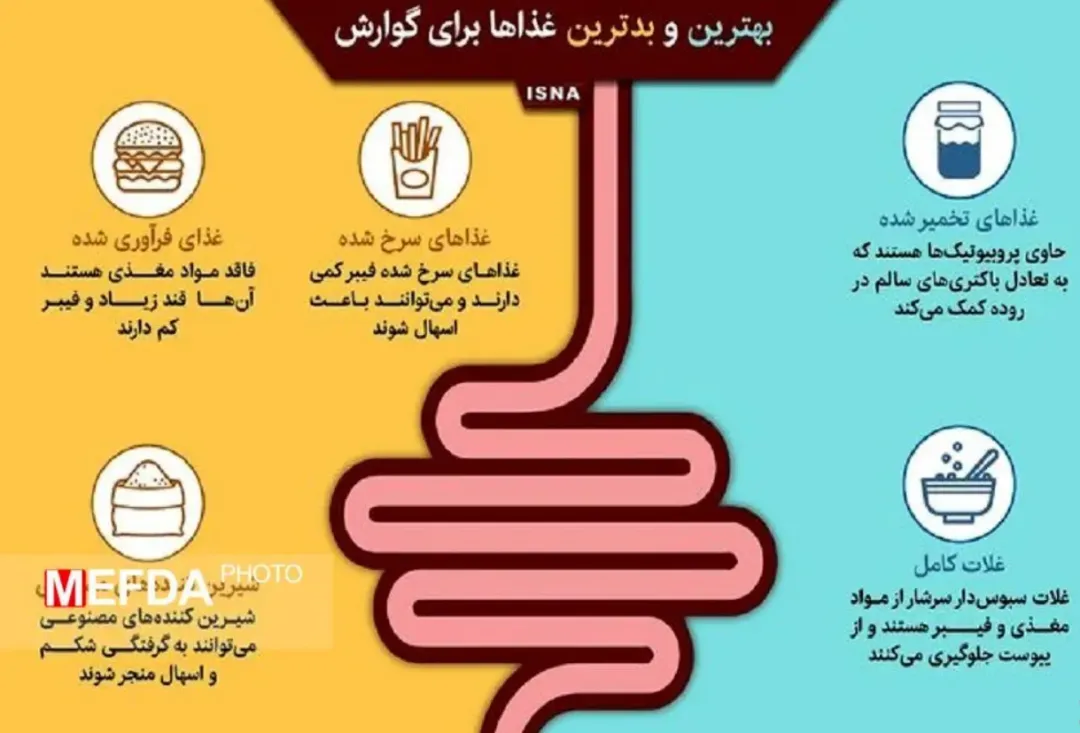 اینفوگرافی: بهترین و بدترین غذاها برای اسهال، یبوست، گرفتگی شکم